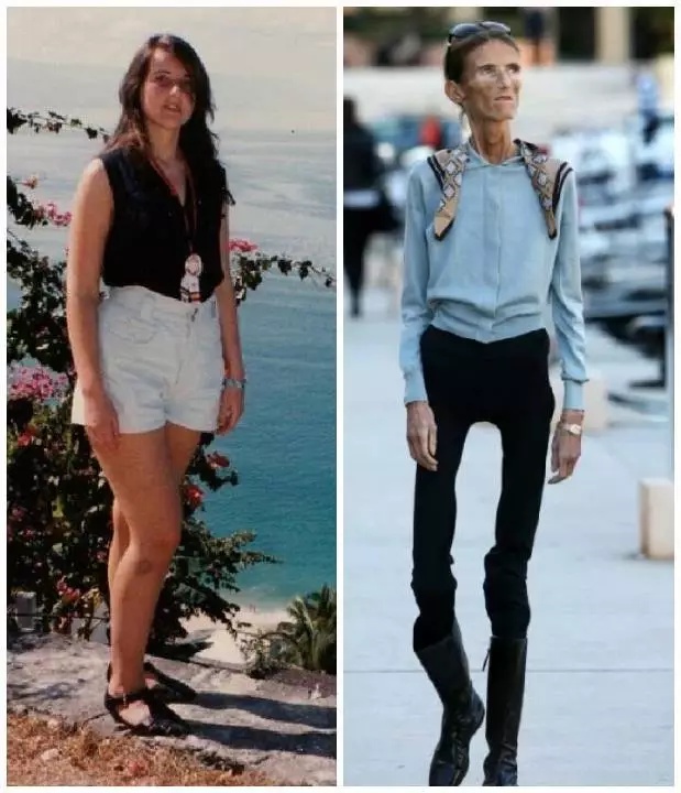 Skinniest Lady In The World